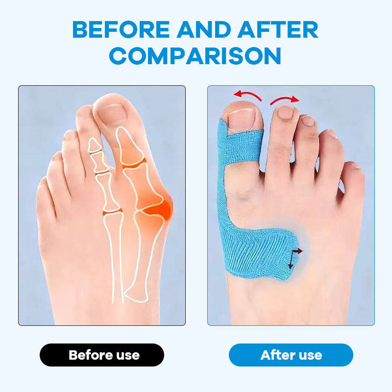 🦶Forhåndskuttet kinesiologitape for hallux valgu