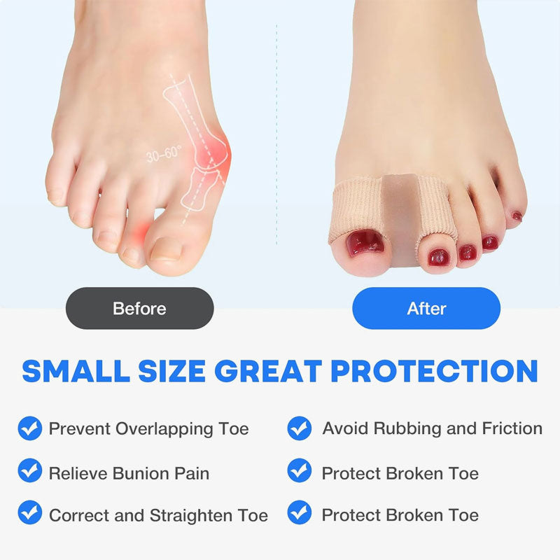 Hallux valgus-korrigerer 🦶